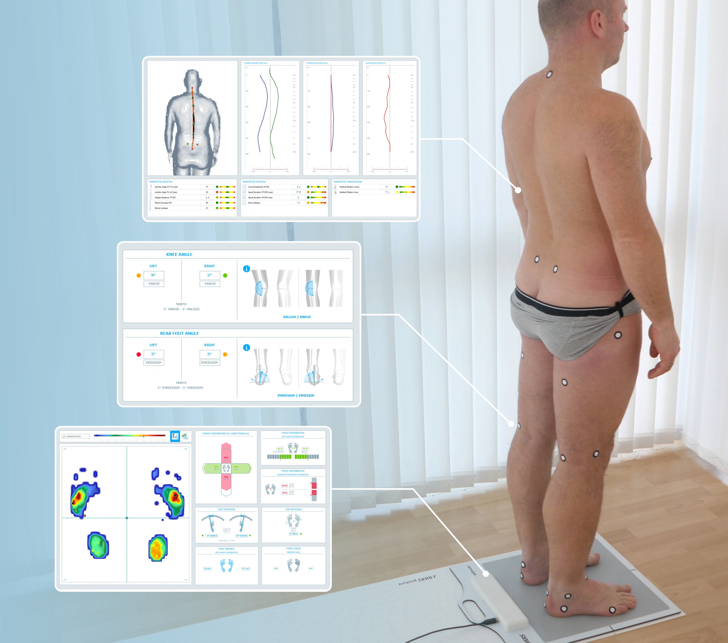 DIERS postura (SOFTWARE License)