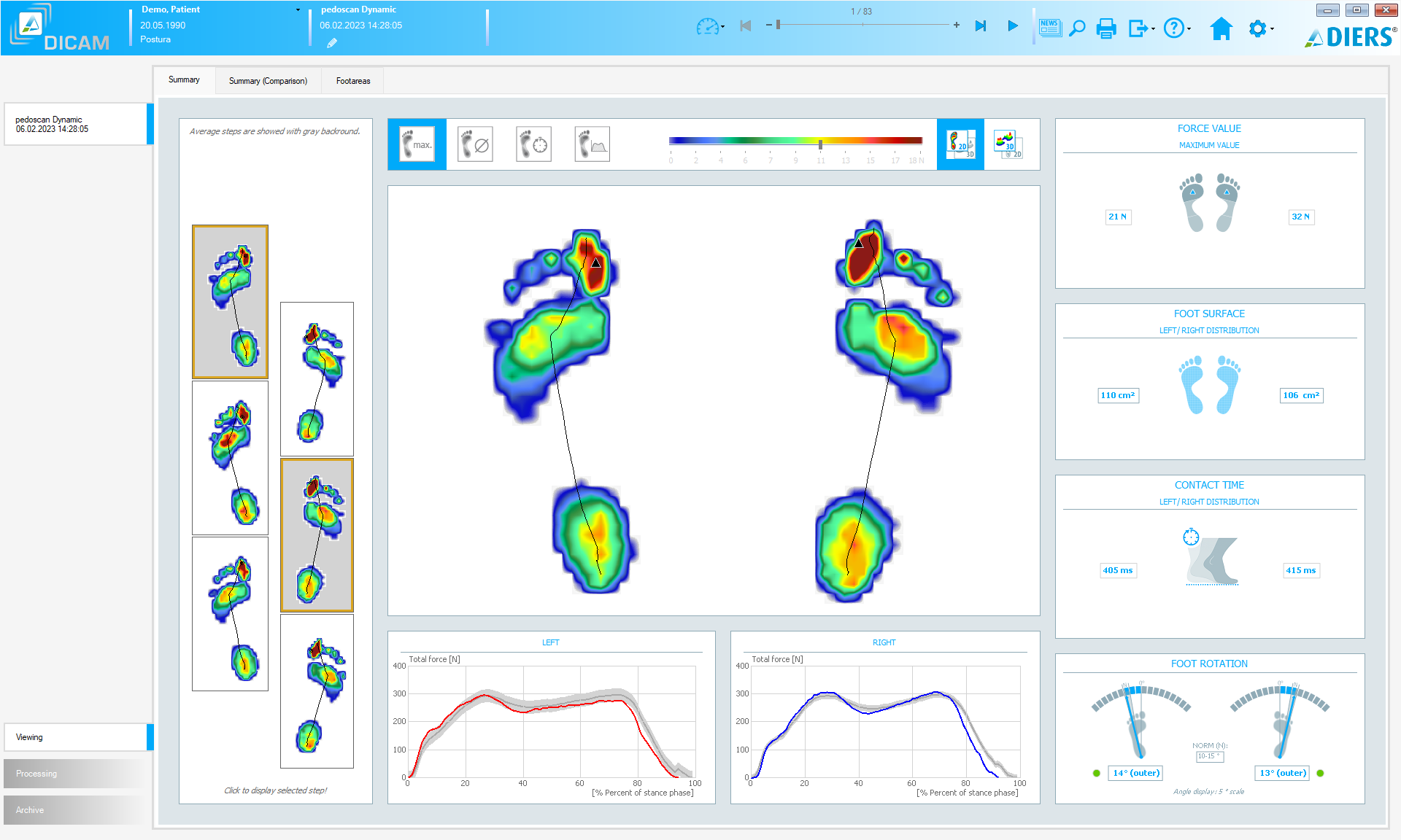DIERS postura (SOFTWARE License)