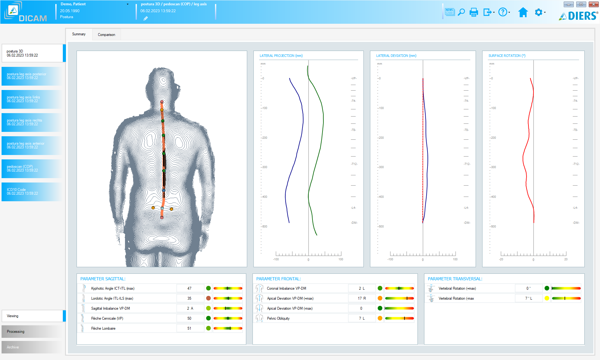 DIERS postura (SOFTWARE License)