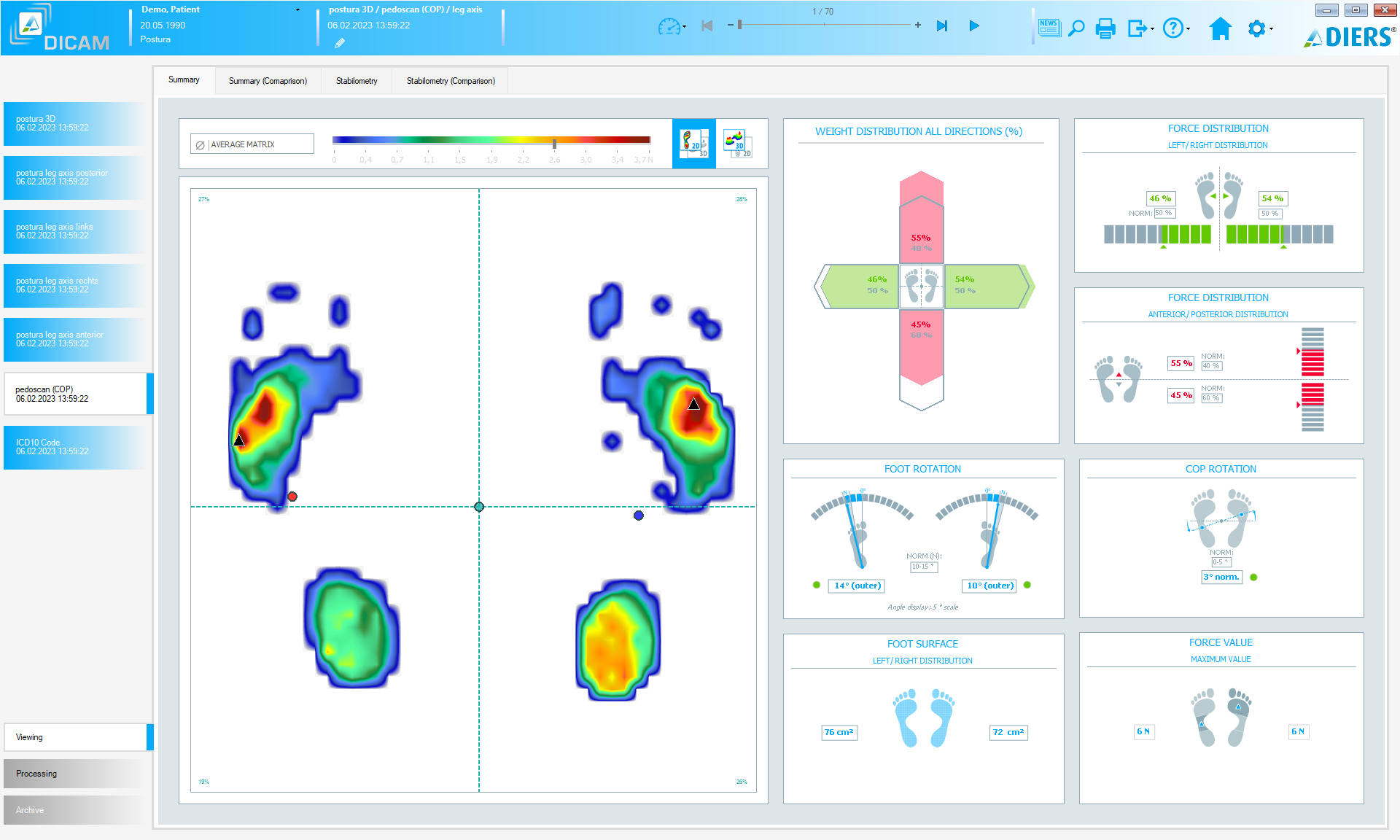 DIERS postura (SOFTWARE License)