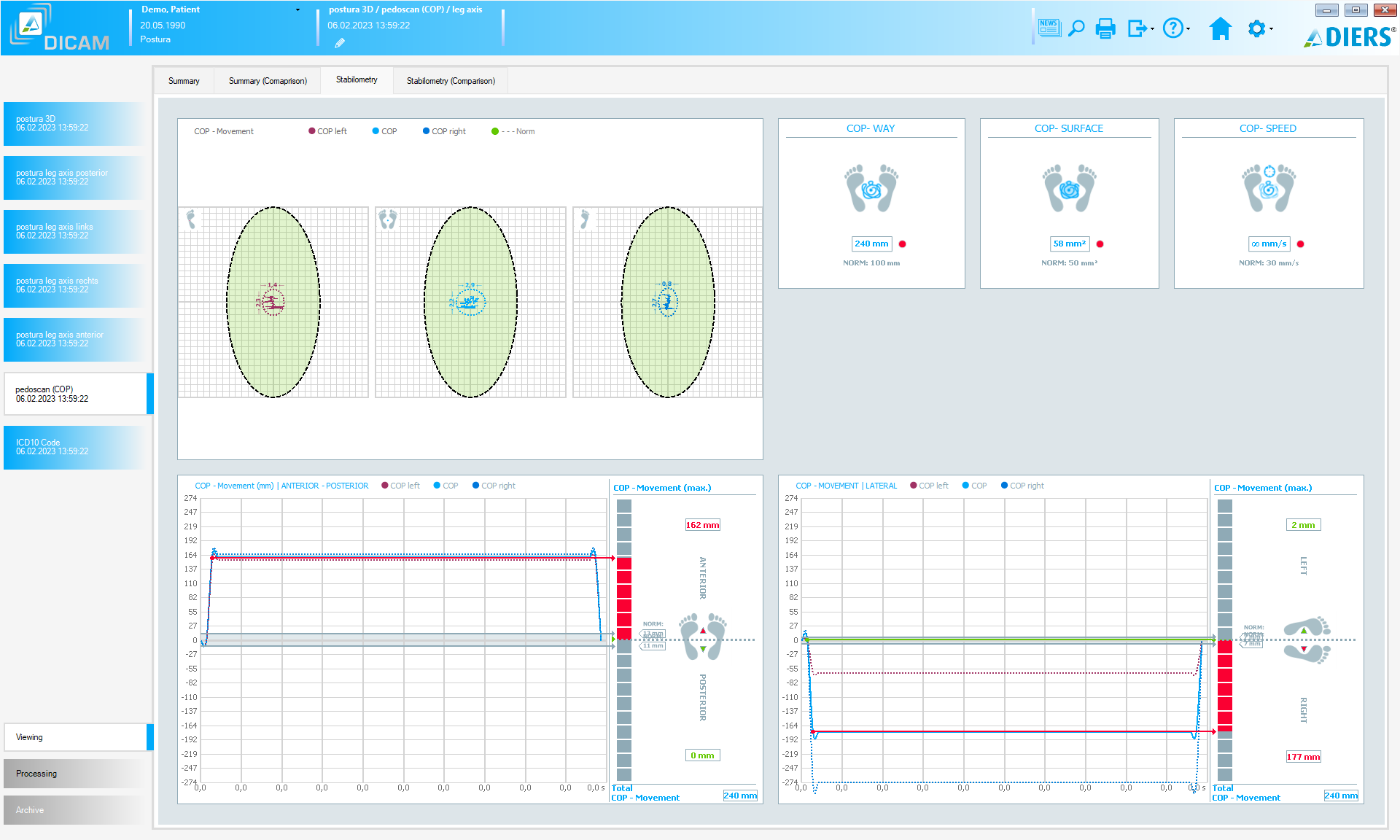DIERS postura (SOFTWARE License)